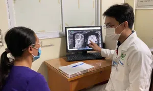 Tiền mất tật mang khi tự ý uống thuốc phòng đột quỵ