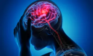 Hai bí quyết giúp ngừa đột quỵ khi trời lạnh